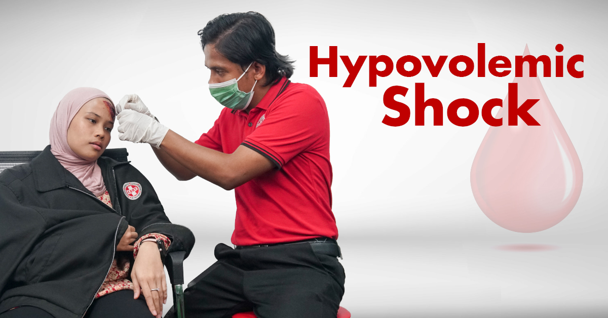 Hypovolemic Shock Understanding, Preventing, and Responding with Basic